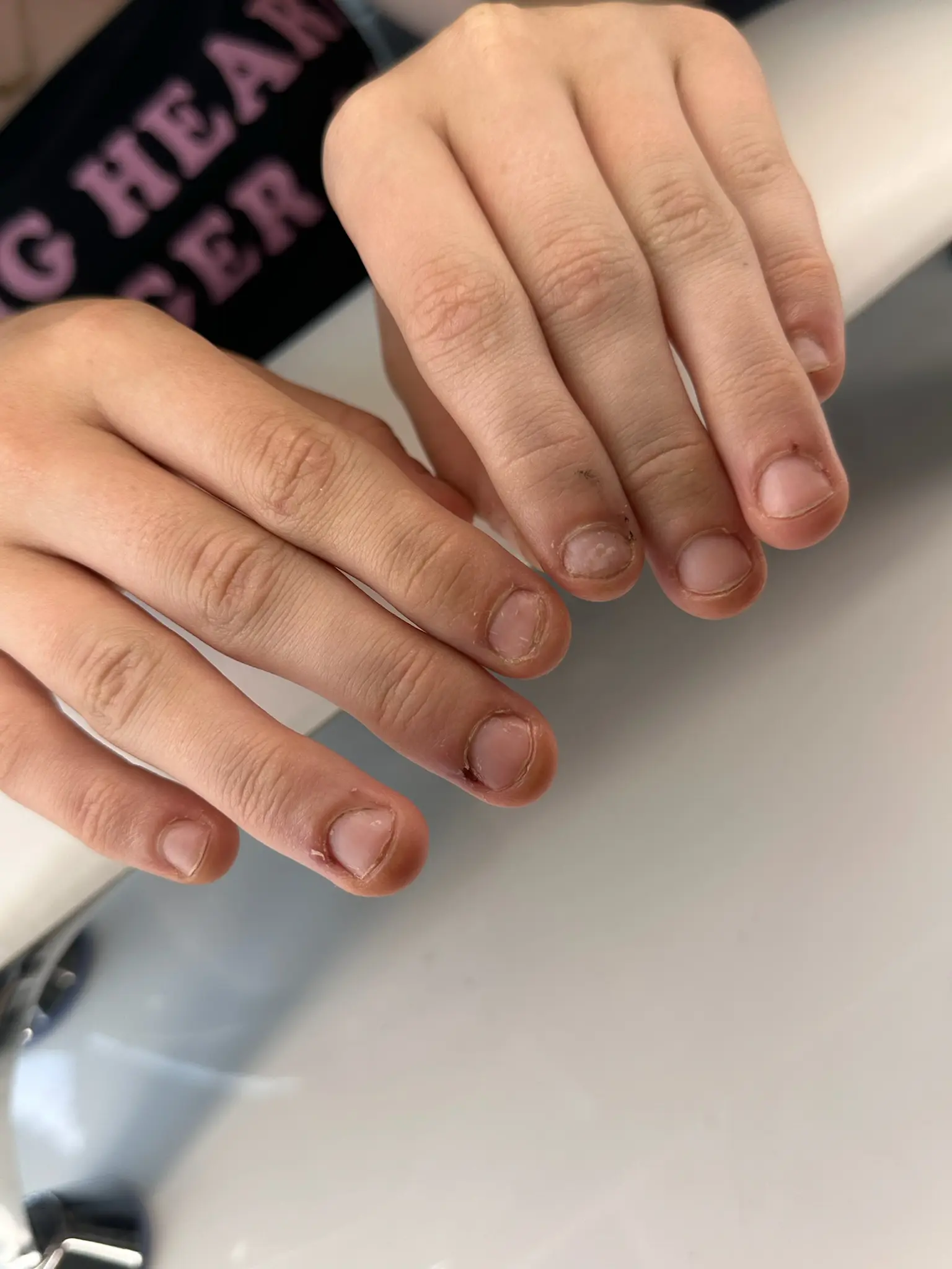 Førbillede af hænder før gele neglebehandling hos BeautyByDau i Sønderborg.